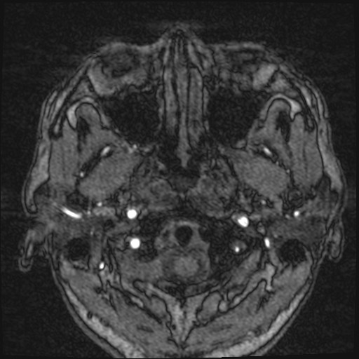 Click on the Serie image to view the images of VILLANUEVA, WILLIAM A.